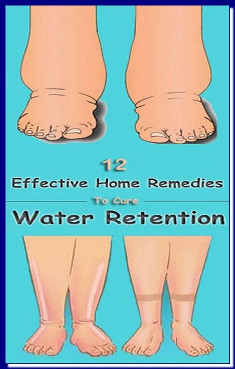 8 Best Home Remedies To Reduce Water Retention Trendsetter Artofit