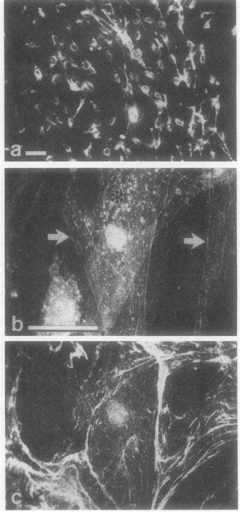 Figure From Plasticity Of Integrin Expression By Nerve Derived