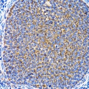 Anti Map Lc A Antibody Produced In Rabbit Sigma Aldrich