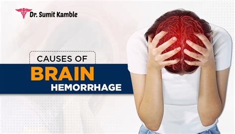 What are the causes of Brain Hemorrhage?