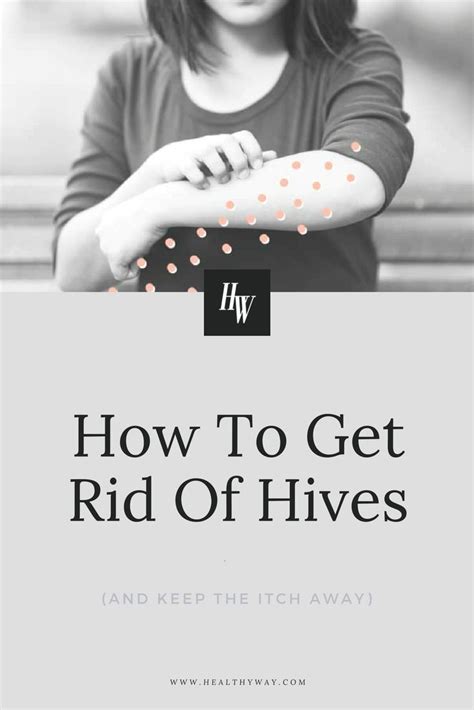 How To Get Rid Of Hives Healthyway Hives Hives Causes Hives Remedies