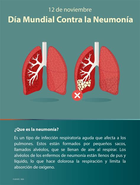 De Noviembre D A Mundial Para La Prevenci N De La Neumon A