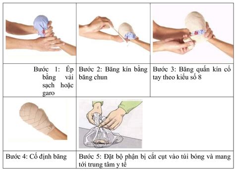 Bộ sưu tập hình ảnh băng bó vết thương ở chân cực chất đầy đủ 4K với