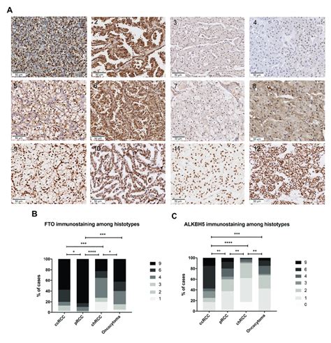 Differential Immunoexpression Of Fto And Alkbh A Illustrative