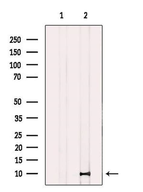 Caspase 1 P10 Cleaved Ala317 Polyclonal Antibody Pa5 105049