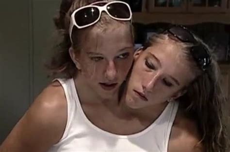 Conjoined Twins Share Exciting News No One Thinks Death Is Imminent Inews