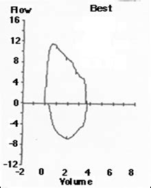 Forced Vital Capacity Graphs Flashcards | Quizlet