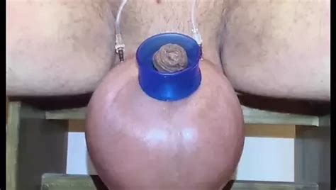 Saline Glucose Timelaps Gay Vintage Amateur Porn Feat Bigballll Xhamster