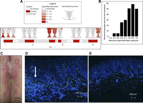 Rapid localized spread and immunologic containment define Herpes