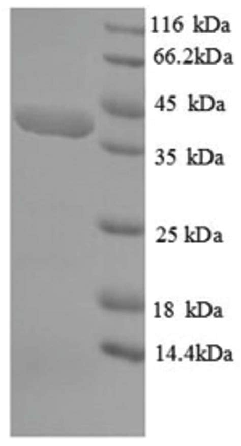 Enquirebio Recombinant Human Speg Apeg Protein Mg Enquirebio