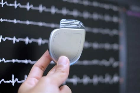 Living With A Permanent Pacemaker Dos And Donts General Diagnostic