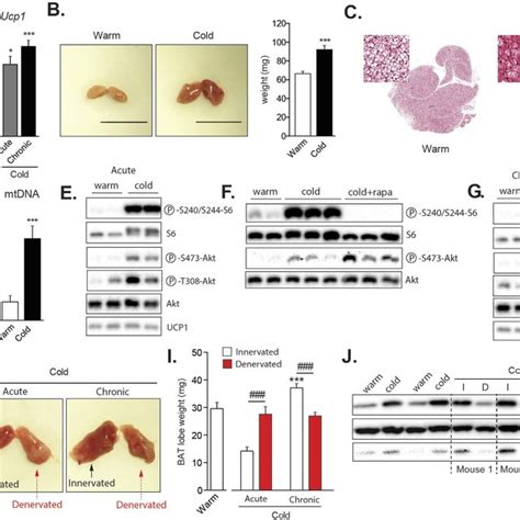 Cold Exposure Promotes Mtorc Activity In Bat Through The Sympathetic