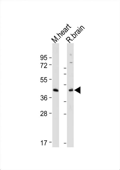 Gper Antibody C Term Affinity Purified Rabbit Polyclonal Antibody