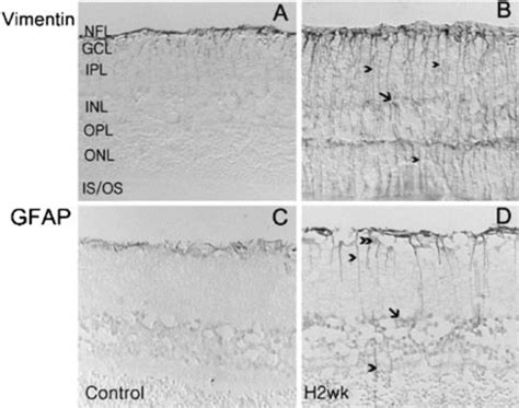 Immunohistochemical Staining For Vimentin A B And Glial Fibrillary