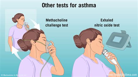 Diagnosing Asthma: Mild, Moderate, and Severe