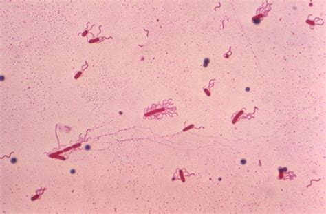 Tinciones Y Colorantes Principales En Microbiología Microbiología