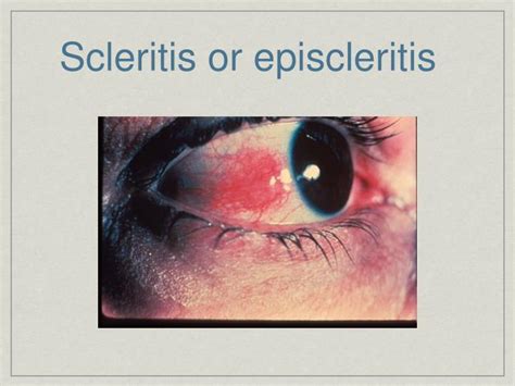 essentials  ophthalmology powerpoint  id