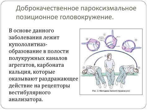 Головокружения: классификация, клиника - презентация онлайн
