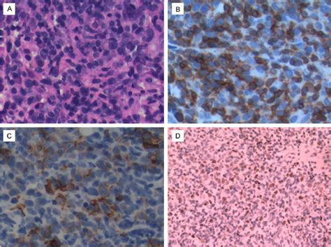 Pathological Findings A The Hematoxylin And Eosin HE Stained