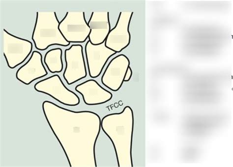 Carpus Diagram Quizlet