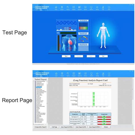 JYtop Quantum Magnetic Resonance Body Analyzer