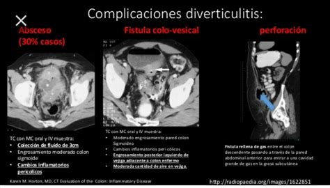 Pin By Liznel Feliberty On Imagenes De Ct Scan Y Mri Historical