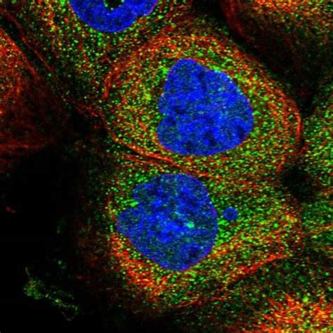 Anti Zswim Antibody Ab Abcam