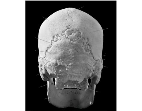 posterior view skull Quiz