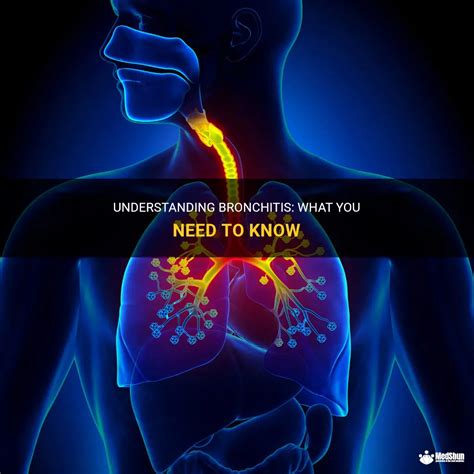 Understanding Bronchitis What You Need To Know Medshun