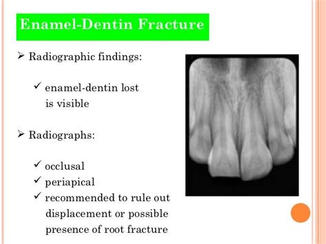 Traumatic Injuries Of Teeth