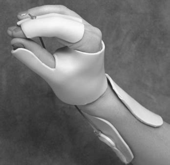 Dynamic Thumb Flexion Splint