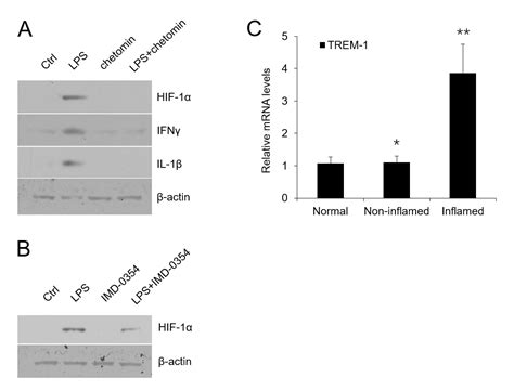 Vitamin D Vdr Signaling Inhibits Lps Induced Ifn And Il In Oral