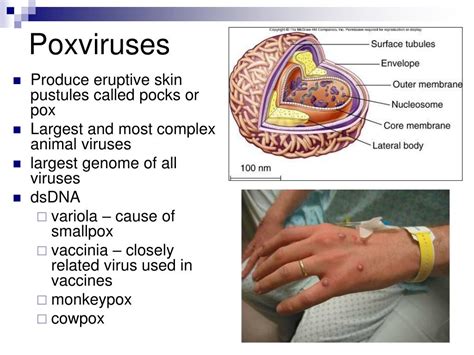 Ppt Viruses And Viral Diseases Powerpoint Presentation Free Download