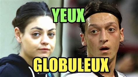 YEUX GLOBULEUX LES SOLUTIONS Pour Avoir Un BEAU REGARD Des Yeux De