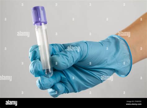 A Medical Expert S Hand In A Sterile Glove Holds A Clean Blue Blood