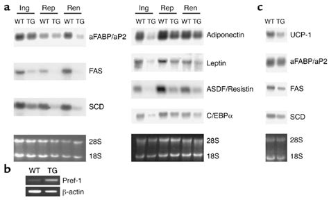 Gene Expression In Adipose Tissue From Ap2 Pref 1hfc Transgenic Mice