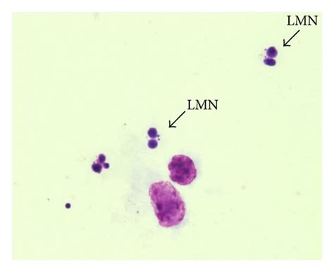 A Photomicroscopy Of Binucleated Lymphocyte Without Micronucleus Download Scientific Diagram