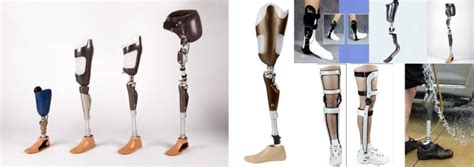 Prosthetics And Orthotics Market Expected To Exceed US 12