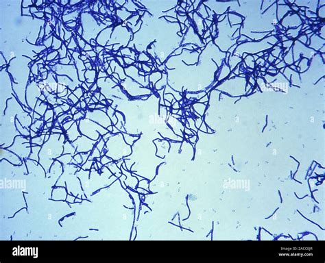 Anthrax Bacteria Light Micrograph Of Anthrax Bacteria Bacillus