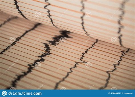 Sinus Heart Rhythm on Electrocardiogram Record Paper Showing Normal P ...