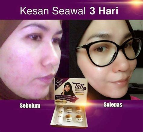 Manfaat Cream Tati Rahasia Kulit Cantik Dan Sehat Versus Beda