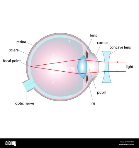 Concave Lens Definition, Uses Examples Video Lesson, 56% OFF