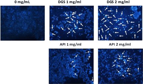 Dapi Staining Microscopy Of Ht Cells Treated For H With Different