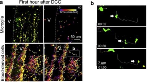 Analysis Of Highly Dense Purkinje Cell Dendritic Spines Using Imaris