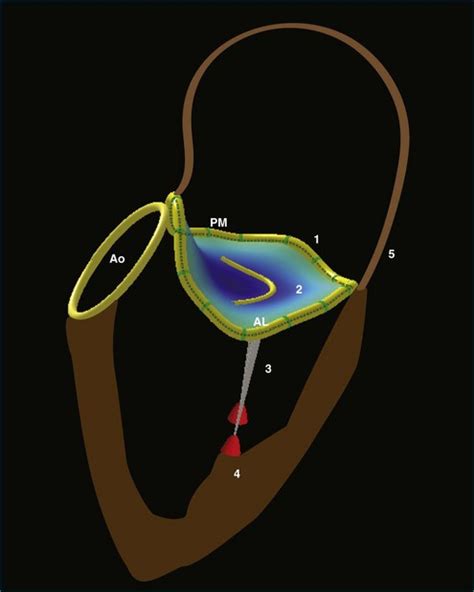 Normal Mitral Valve Anatomy And Measurements Clinical Gate