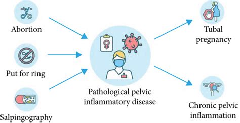 [retracted] Analysis Of Infertility Factors Caused By Gynecological Chronic Pelvic Inflammation