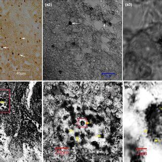 Distribution Of Bdalabeled Cells In Lymph Nodes A A And Gold