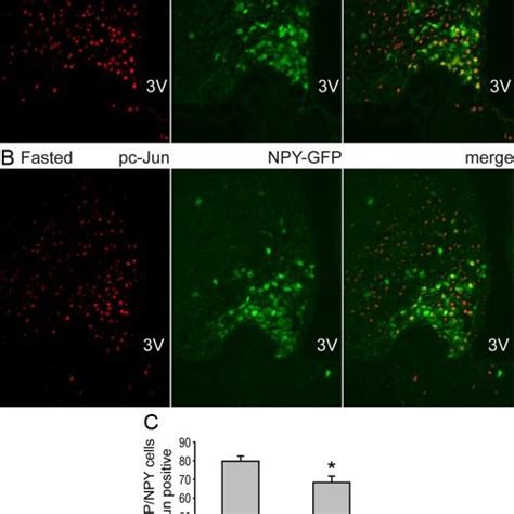 Phosphorylation Of Serine At The C Jun N Terminal Domain Is Reduced