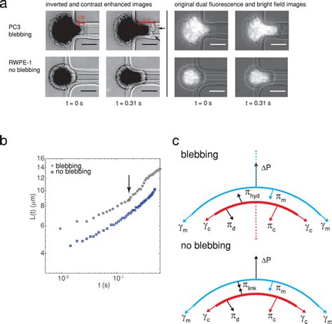 (a) A highly metastatic PC3 prostate cancer cell forms plasma membrane ...