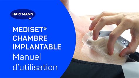 Mediset Chambre Implantable Manuel D Utilisation Youtube